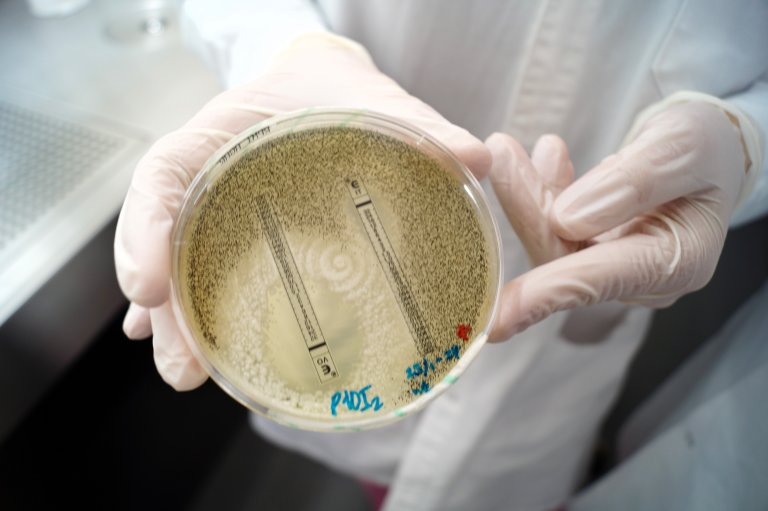 This is what it looks like when researchers examine the degree of resistance in A. fumigatus. The two "strips" each emit their own azole-based inhibitory agent at different concentrations. The concentration is highest at the top of the "strip" (marked with an "E"). By studying how close to the top of the "strip" the fungus grows, the researchers can assess how resistant the fungus is. The depicted fungus is more inhibited by the "strip" on the left than by the "strip" on the right. Photo: Silje Kvist Simonsen