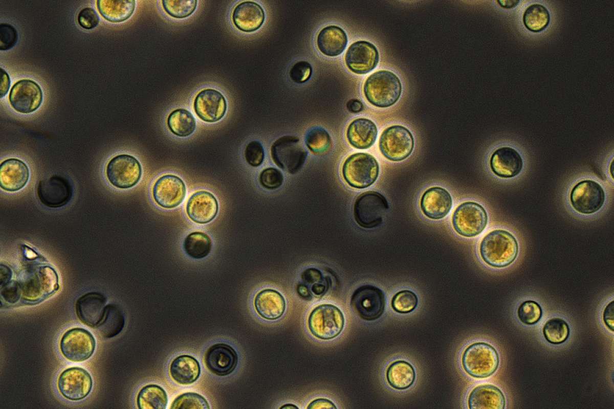 Chlorella vulg SAG 211-1b_Chlorella vulg015_ch00_cropped.jpg