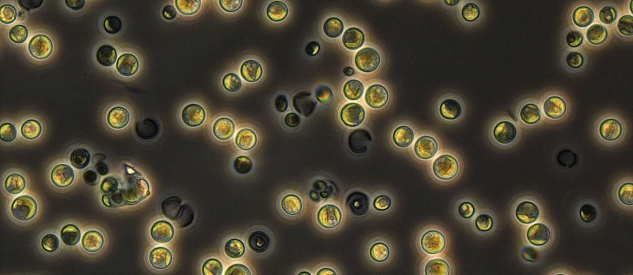 Chlorella vulg SAG 211-1b_Chlorella vulg015_ch00_cropped.jpg